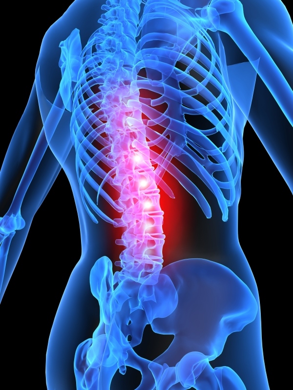 Spinal Decompression Therapy in Longview